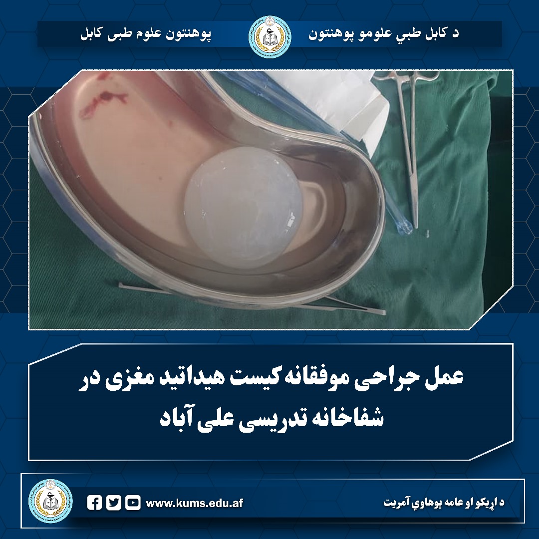 عمل جراحی کیست هیداتید مغزی با موفقیت انجام شد