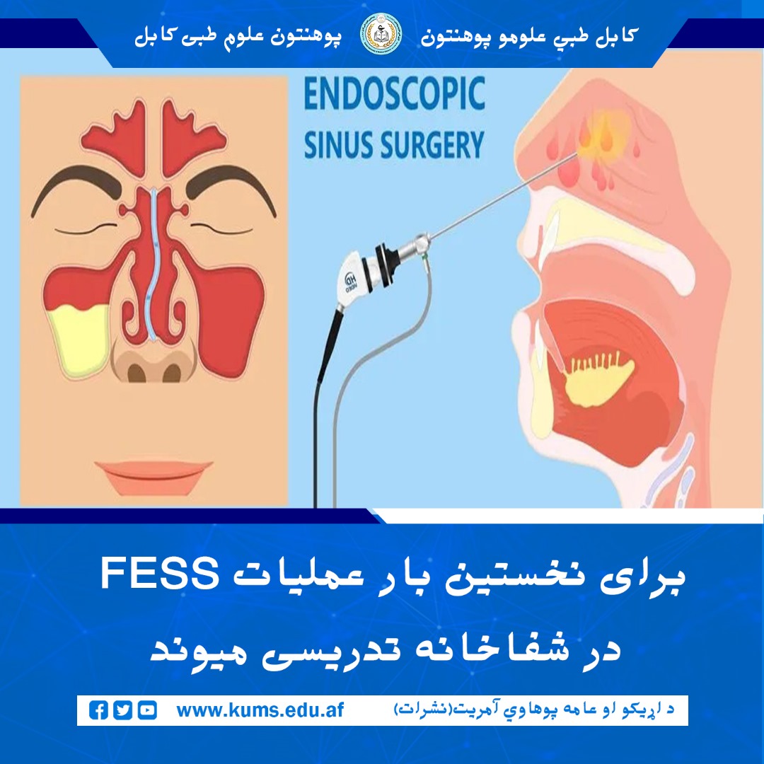 برای نخستین‌ بار عملیات پیشرفته   FESSیا (Functional Endoscopic Sinus Surger ) در شفاخانه تدریسی میوند توسط تیم متخصصین دیپارتمنت گوش و گلو با همکاری داکتر حامد مشرقی بر کودک ۱۲ ساله باشنده ولایت ارزگان انجام گردید.