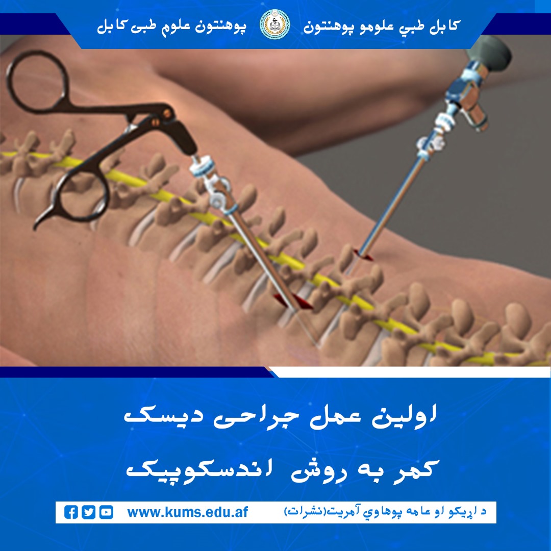 تیم جراحی دیپارتمنت اورتوپیدی شفاخانه تدریسی علی‌آباد پوهنتون علوم طبی کابل « ابو علی ابن سینا» عمل جراحی به روش  Endoscopic Lumbar Discectomy را با موفقیت روی بیمار ۴۰ ساله‌ باشندۀ ولایت بدخشان، انجام داد.