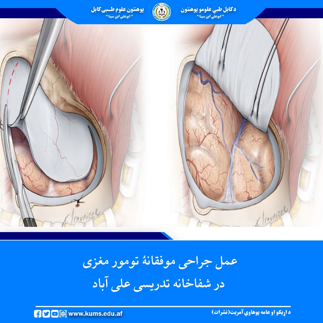 یک بیمار ۲۲ ساله، باشندهٔ ولسوالی شکردرهٔ کابل، که از تومور مغزی رنج می‌برد، در بخش جراحی اعصاب شفاخانه تدریسی علی آباد پوهنتون علوم طبی کابل تحت عمل جراحی موفقانه قرار گرفت.