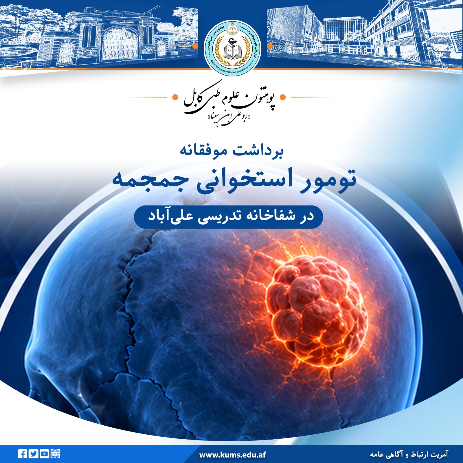 تومور